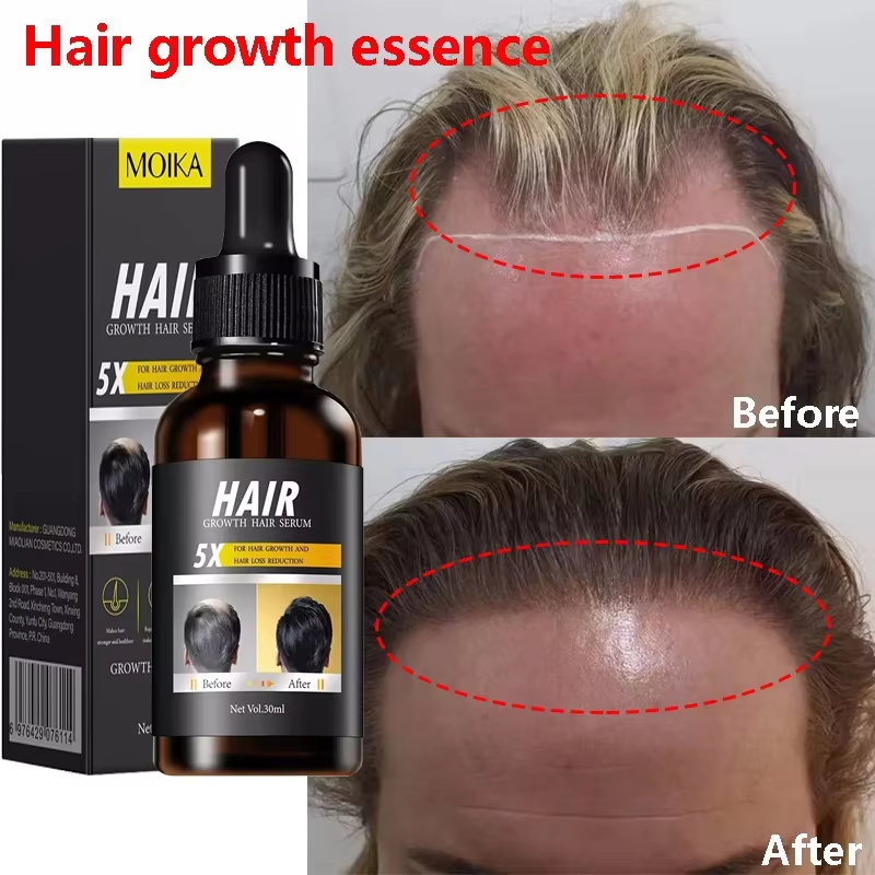 Hair Care Essential Oil Atomizing - Sérum para Crescimento Rápido de Cabelo,