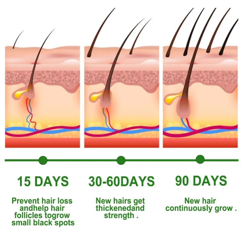 Soro de crescimento capilar, c - Hair Care Essential Oil Atomizing avaliação e preço