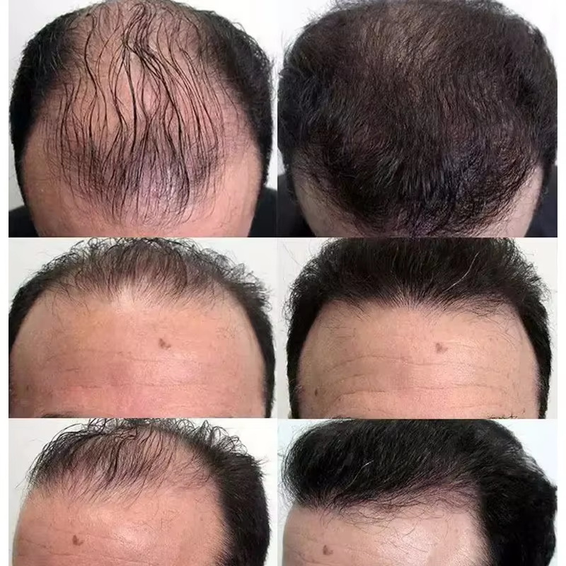 Sérum para Crescimento Rápido  - Hair Care Essential Oil Atomizing avaliação e preço