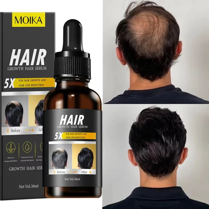 Sérum para Crescimento Rápido  - Hair Care Essential Oil Atomizing avaliação e preço