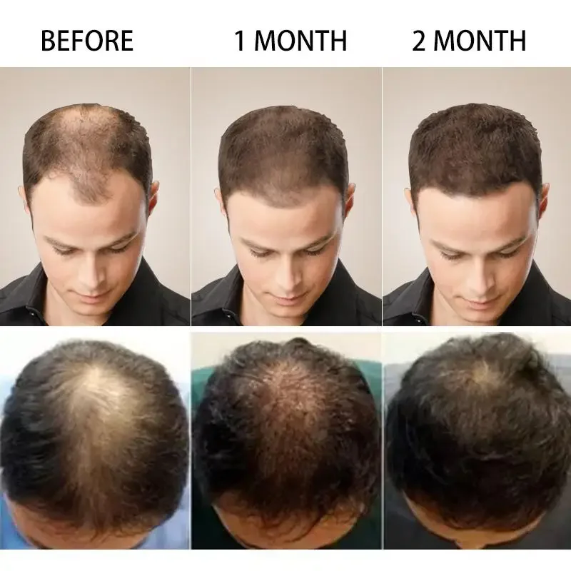 Crescimento do cabelo gengibre - Hair Care Essential Oil Atomizing avaliação e preço